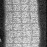 rentgenový snímek